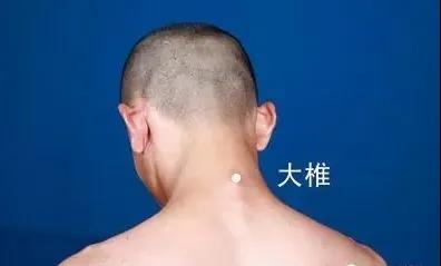 春天灸灸背，能活一百歲~